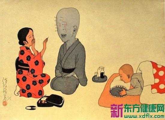 \