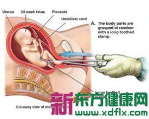 20120407050545556.jpg